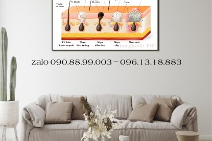 Tranh Tráng Gương Các Loại Mụn – Gợi Mở Sự Chuyên Nghiệp Nhẹ Nhàng Cho Spa, Thẩm Mỹ Viện