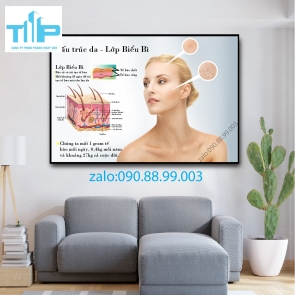 Tranh tráng gương filler - meso