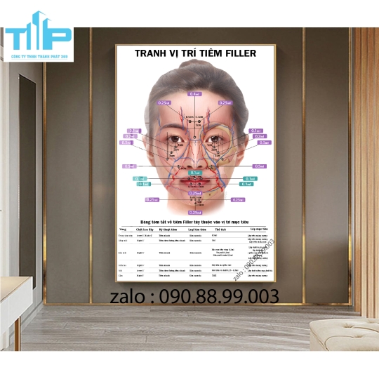 Khung tranh tráng gương  tiêm filler botox