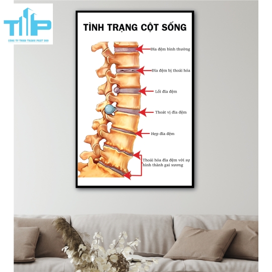 Tranh tráng gương huyệt đạo châm cứu 