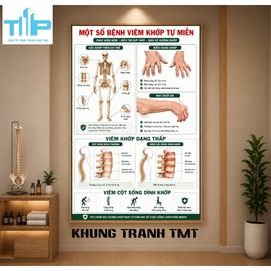 Tranh Tráng Gương Bệnh Lý Cột Sống – Lựa Chọn Hàng Đầu Cho Spa Và Phòng Khám