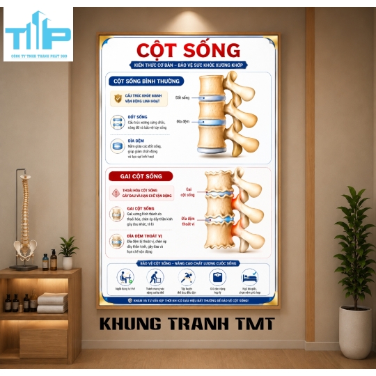 Tranh Tráng Gương Bệnh Lý Cột Sống – Lựa Chọn Hàng Đầu Cho Spa Và Phòng Khám