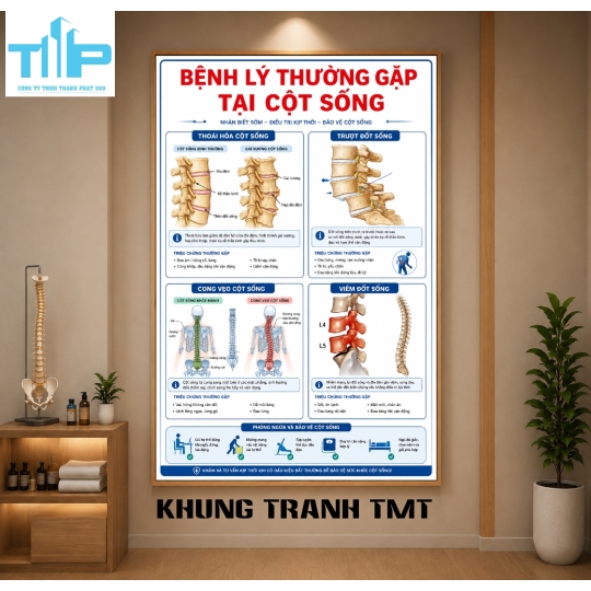 Tranh Tráng Gương Bệnh Lý Cột Sống – Lựa Chọn Hàng Đầu Cho Spa Và Phòng Khám