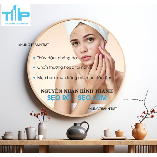 Tranh tròn điều trị mụn, mesotherapy theo liệu trình phù hợp - Tranh tráng gương sắc nét  decor spa, thẩm mỹ viện toàn quốc